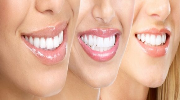 Our Patients’ Healthy Teeth is №1 Priority
