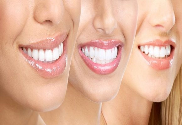 Our Patients’ Healthy Teeth is №1 Priority