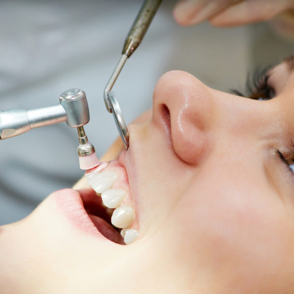 Dental Cleaning