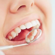 Missing Teeth Predict Strokes